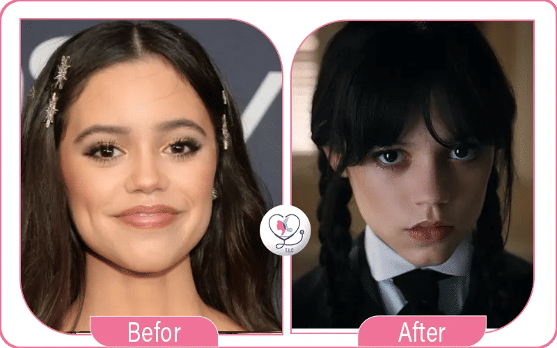 Les rumeurs de chirurgie esthétique autour de Jenna Ortega