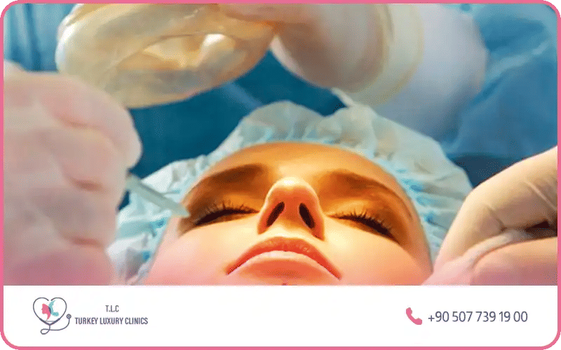 Rhinoplastie ultrasonique Turquie avantages