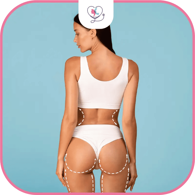 ما هي عملية شفط دهون الارداف؟