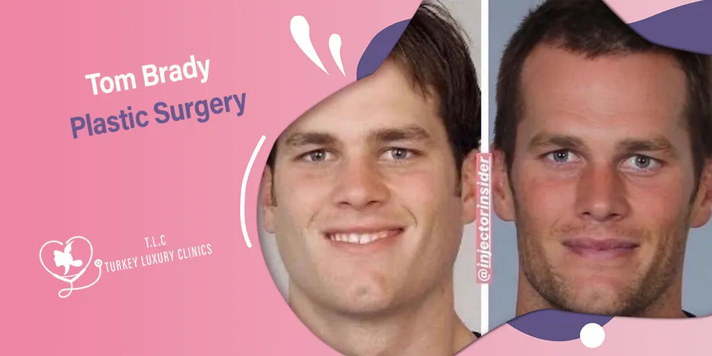 Tom Brady Plastische Chirurgie: Verjüngung, Gerüchte oder Wahrheit?