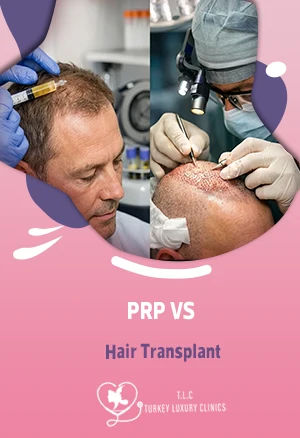PRP vs Hair Transplant: Which Treatment Restores Hair Best?featured image