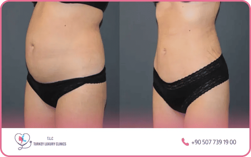 résultat est naturel