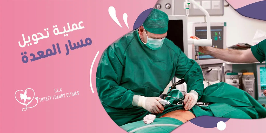 عملية تحويل مسار المعدة: الأنواع والتكلفة ونسبة نزول الوزن