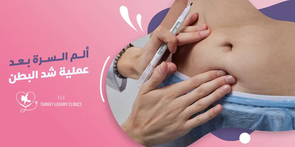 الم السرة بعد عملية شد البطن