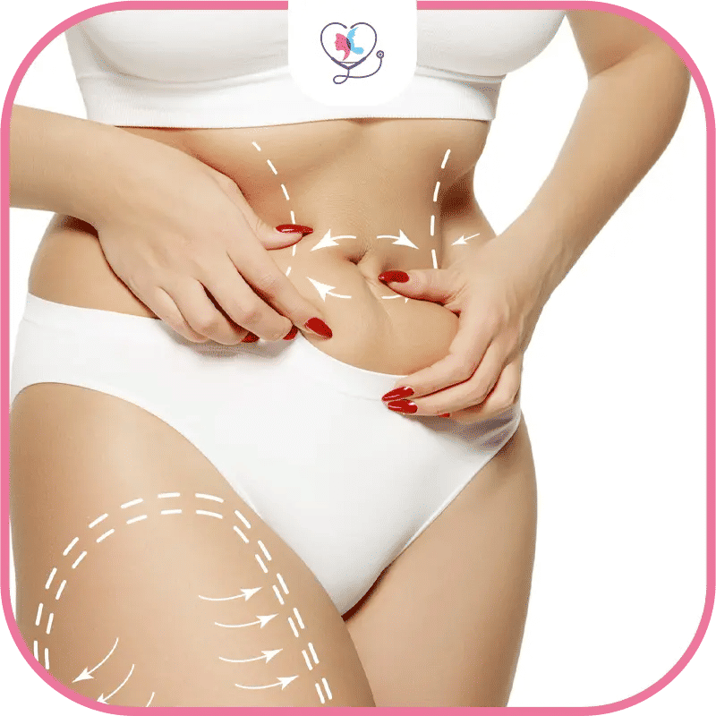 ما الفرق بين شفط الدهون وشد البطن؟