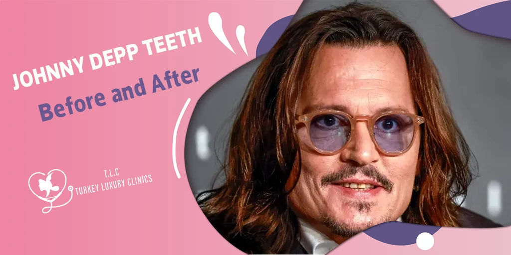 Johnny Depp Teeth Before and After: The Dramatic Smile Transformation Explained