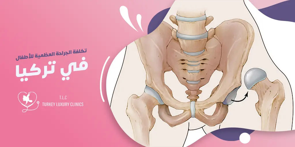 كم تبلغ تكلفة جراحة العظام للأطفال في تركيا؟
