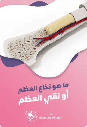 ما هو نخاع العظم أو نقي العظم؟featured image
