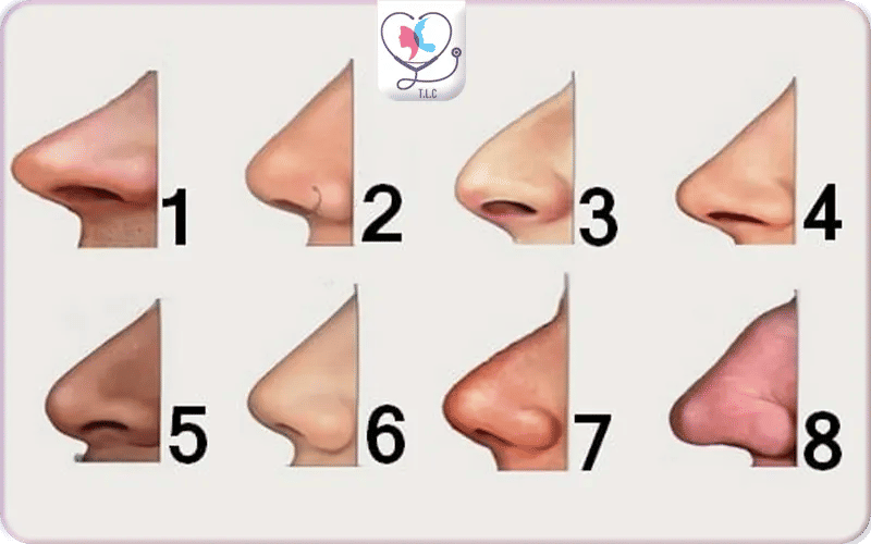les différents type de nez