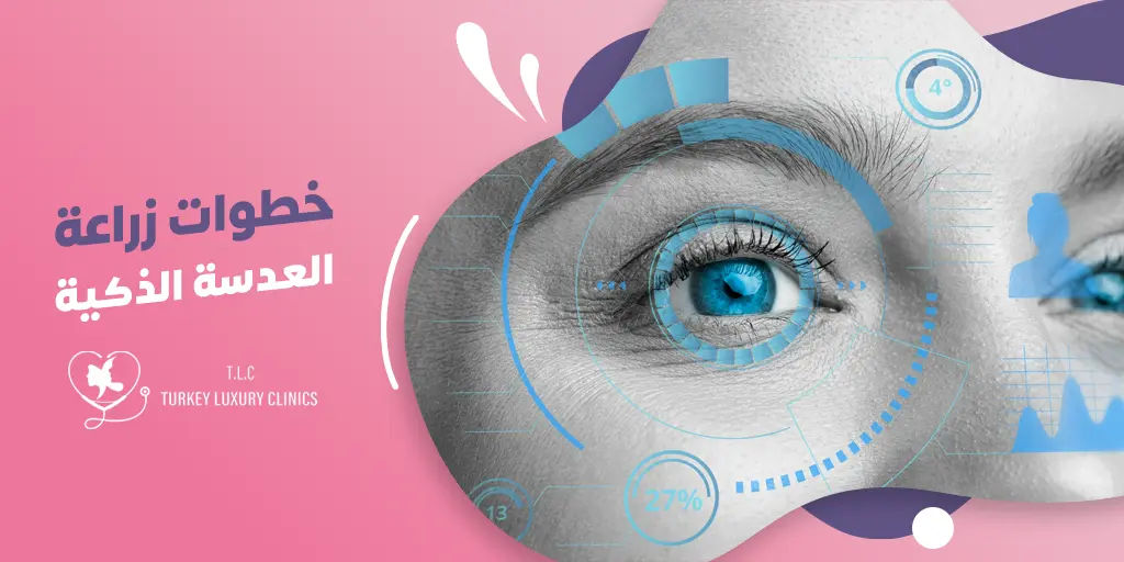 خطوات زراعة العدسة الذكية 
