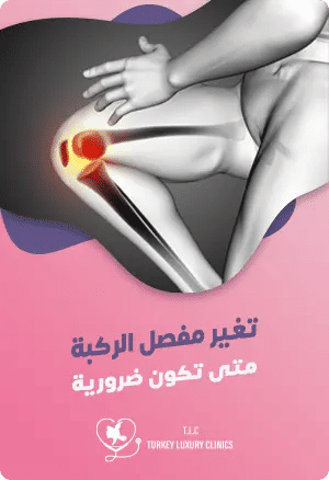 متى تكون عملية تغيير مفصل الركبة ضرورية؟featured image