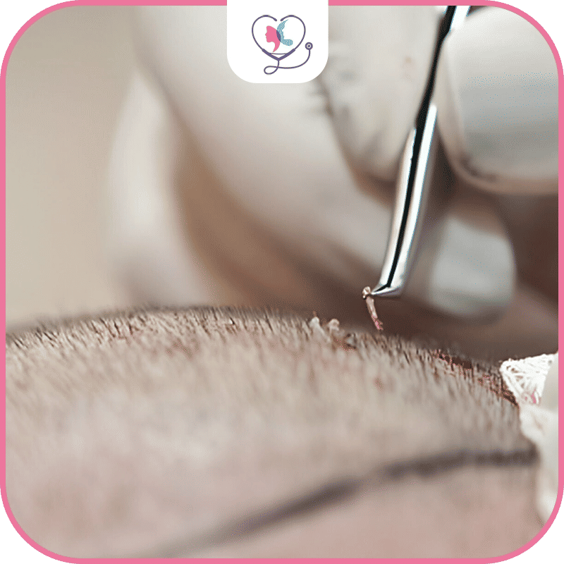 Instructions for a Safe Recovery and Guaranteed Results