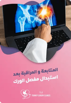 المتابعة والمراقبة بعد استبدال مفصل الورك: الأهمية والبقاء يقظاًfeatured image