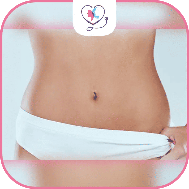 شكل السرة بعد عملية شد البطن