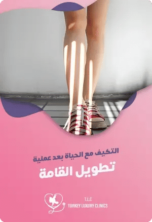 التكيف مع الحياة بعد عملية تطويل القامةfeatured image