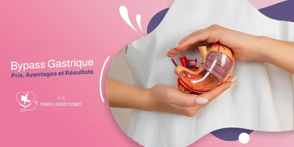 Bypass Gastrique – Prix, Avantages et Résultats