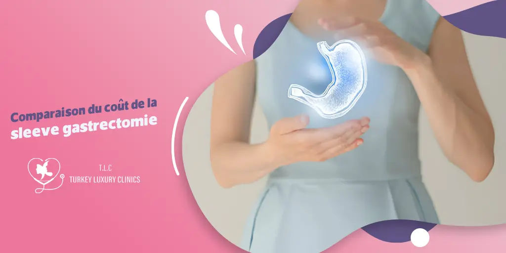Comparaison du coût de la sleeve gastrectomie