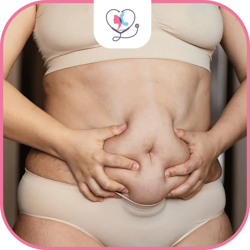 ما الفرق بين عملية  نحت عضلات البطن وشفط الدهون؟