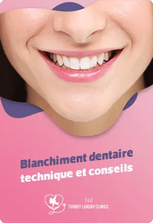 Blanchiment dentaire : technique et conseils
