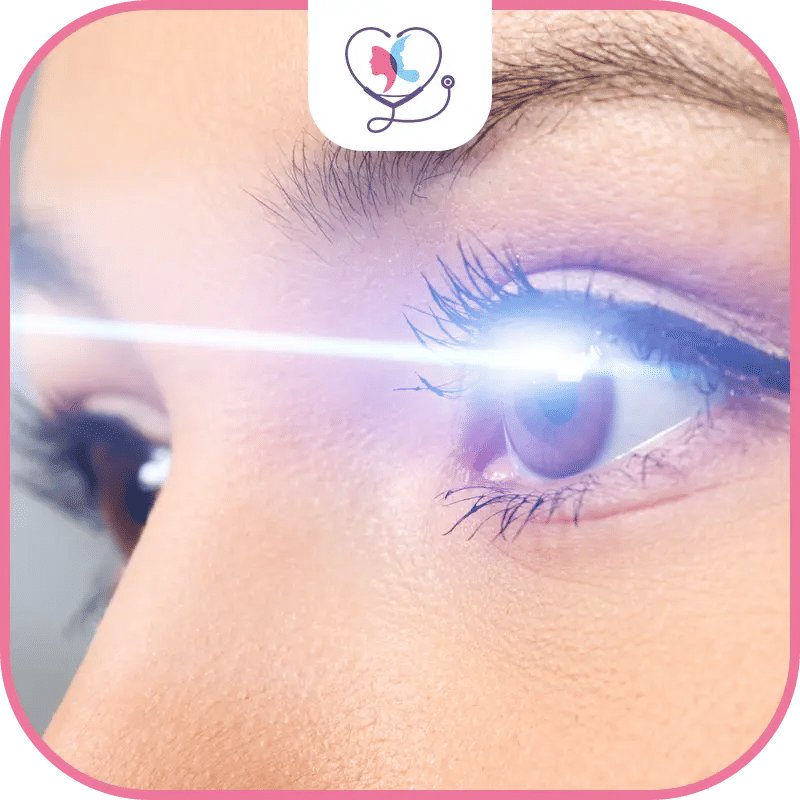 تكلفة عملية الليزك في تركيا