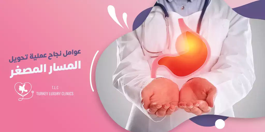 عوامل نجاح عملية تحويل المسار المصغر