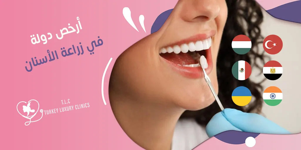 أرخص دولة في زراعة الأسنان: مقارنة بين جميع الدول