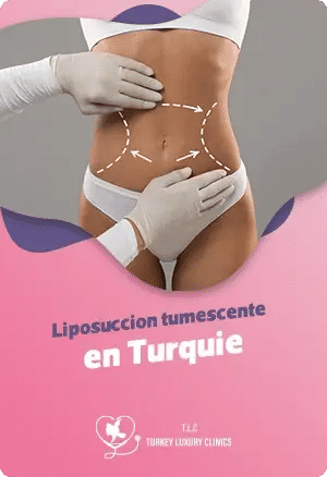 Liposuccion tumescente en Turquie