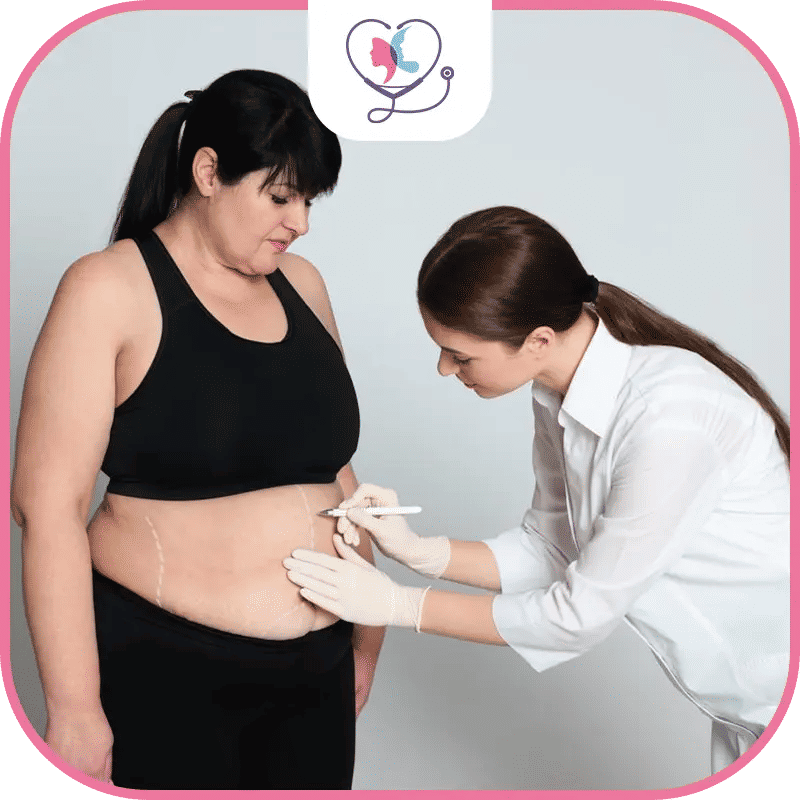 ما هي جراحة السمنة Bariatric surgery