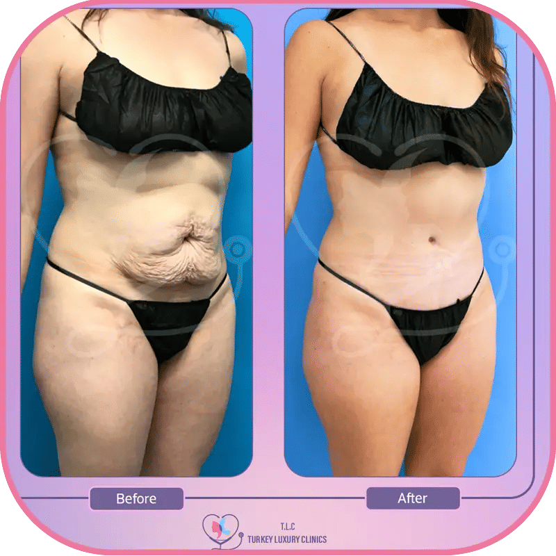 ثانياً: مناطق الجسم المستهدفة