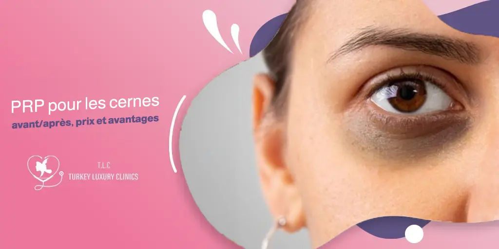 PRP pour les cernes : avant/après, prix et avantages