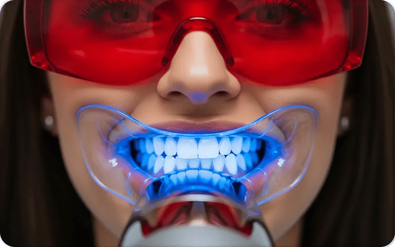 ما هو تبييض الأسنان بالليزر؟