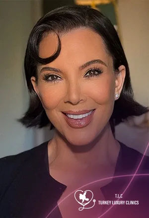 Did Kris Jenner Have a Face Lift? Explore Before & After Photos