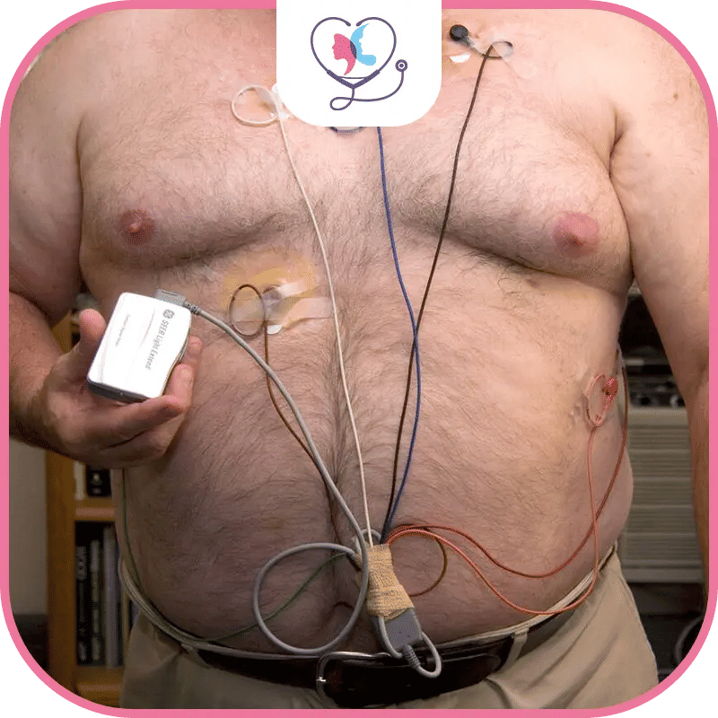 ما هي موانع عملية تكميم المعدة؟