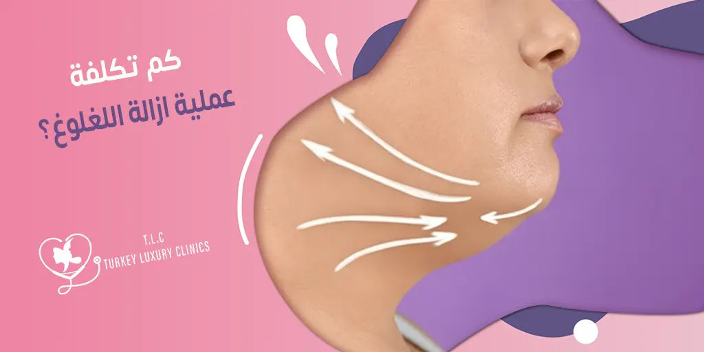 كم تكلفة عملية ازالة اللغلوغ؟ تركيا، السعودية، باقي الدول