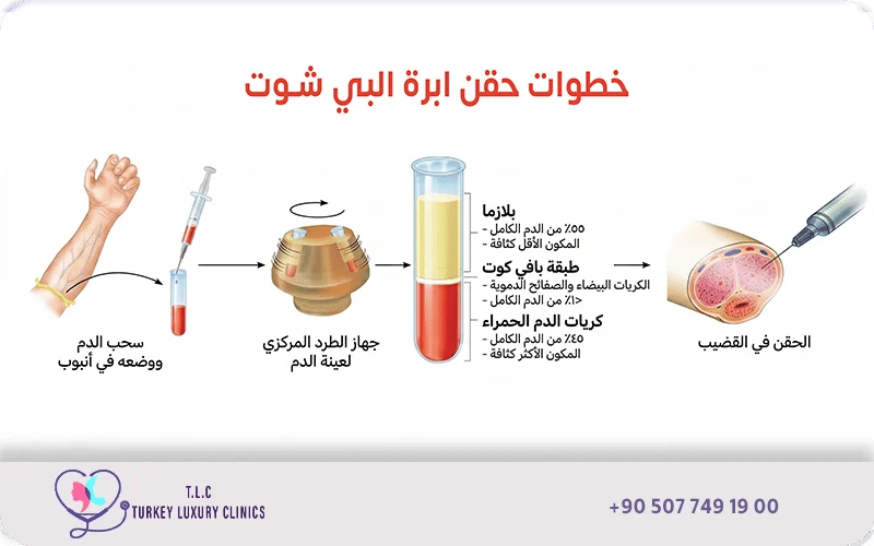 خطوات حقن ابرة البي شوت