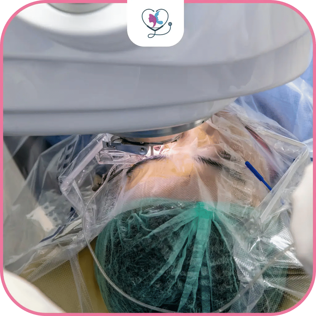 خطوات إجراء عملية الفاكو في تركيا