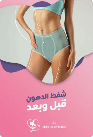 شفط الدهون قبل وبعدfeatured image