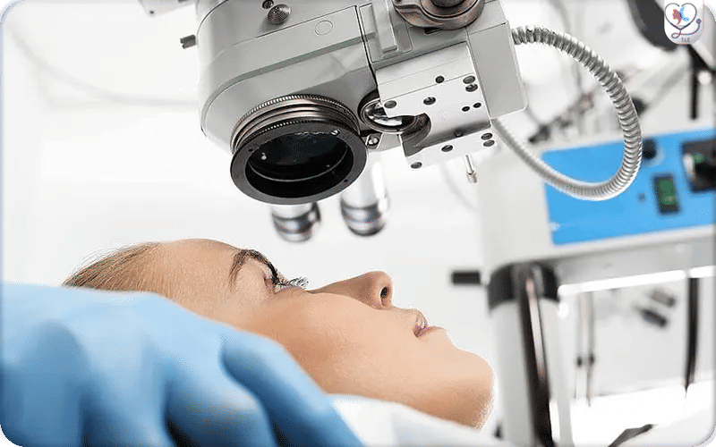 Qu’est-ce qu’une opération laser des yeux ?