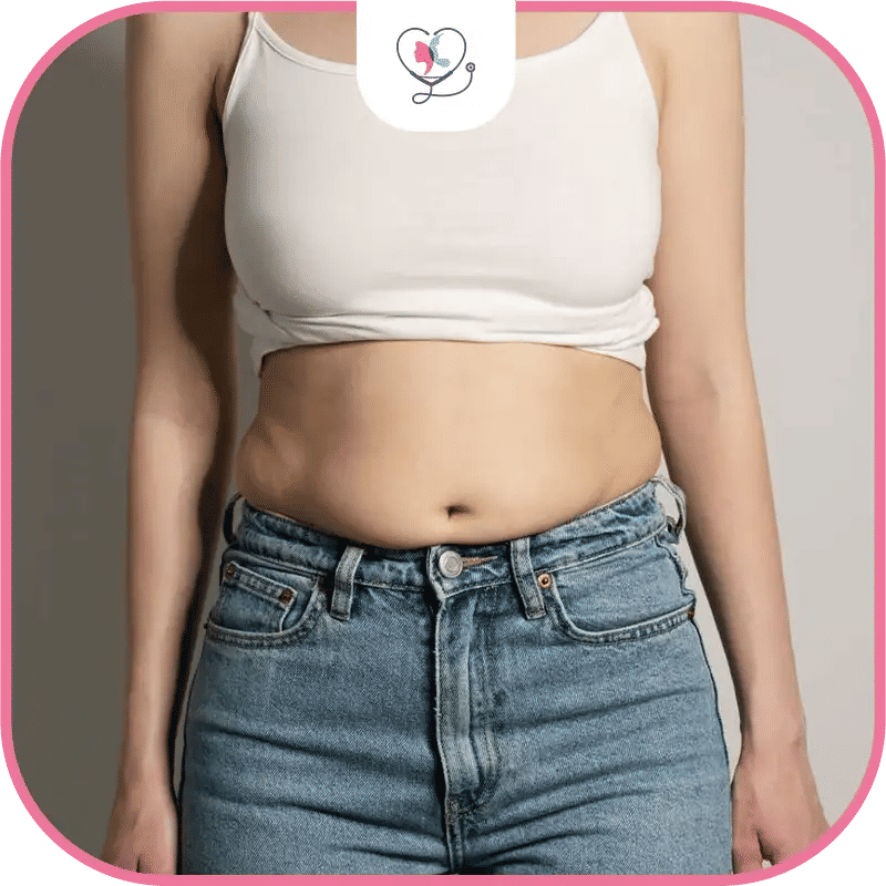 العمر المناسب لعملية شفط الدهون