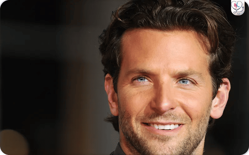 Bradley Cooper avant / après chirurgie-2