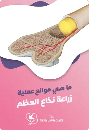 ما هي موانع عملية زراعة نخاع العظمfeatured image