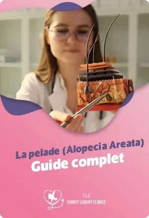 La pelade (Alopecia Areata) : Guide complet