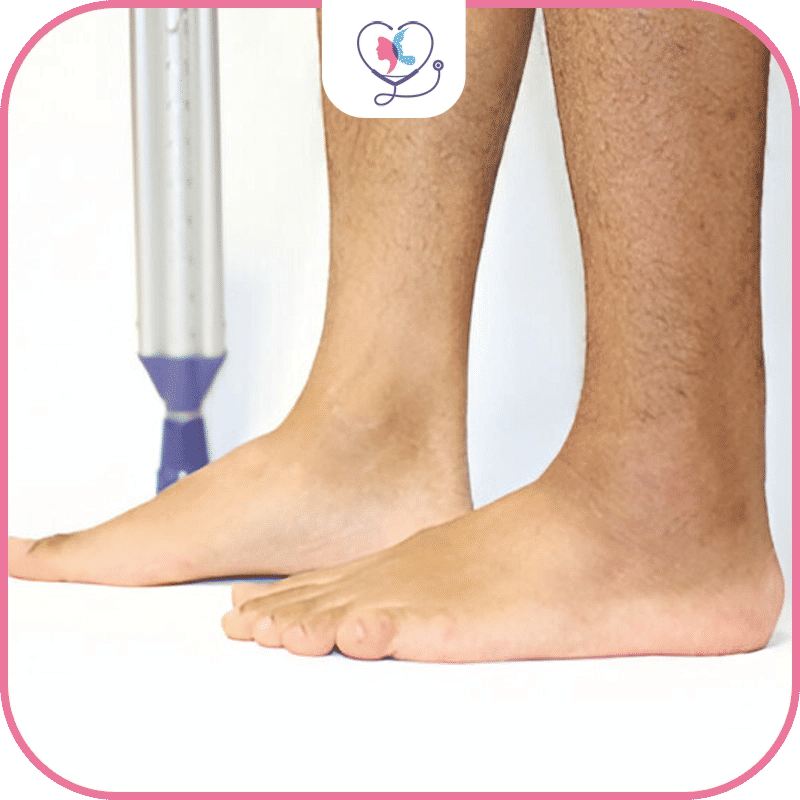 ما هي العوامل التي تؤثر على عملية تطويل القامة؟