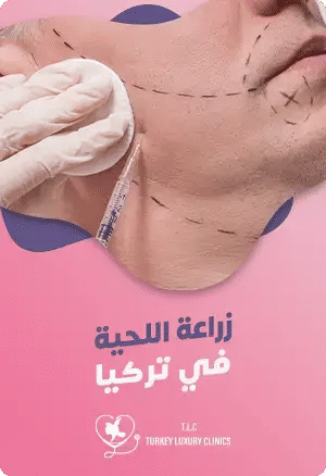 زراعة اللحية في تركيا - إطلالة جديدة وجذابةfeatured image