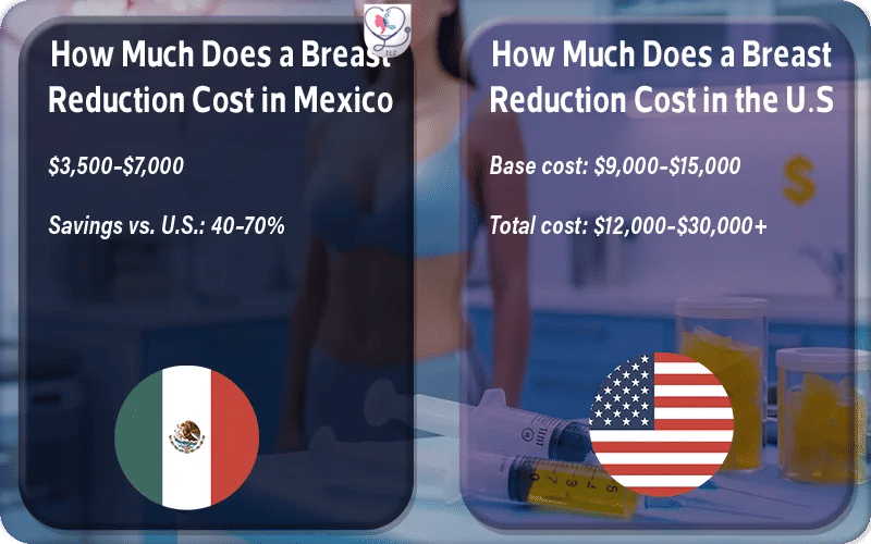 How Much Does a Breast Reduction Cost in Mexico