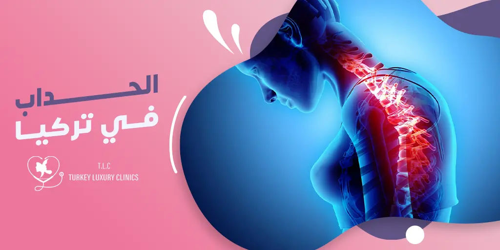 عملية الحداب في تركيا