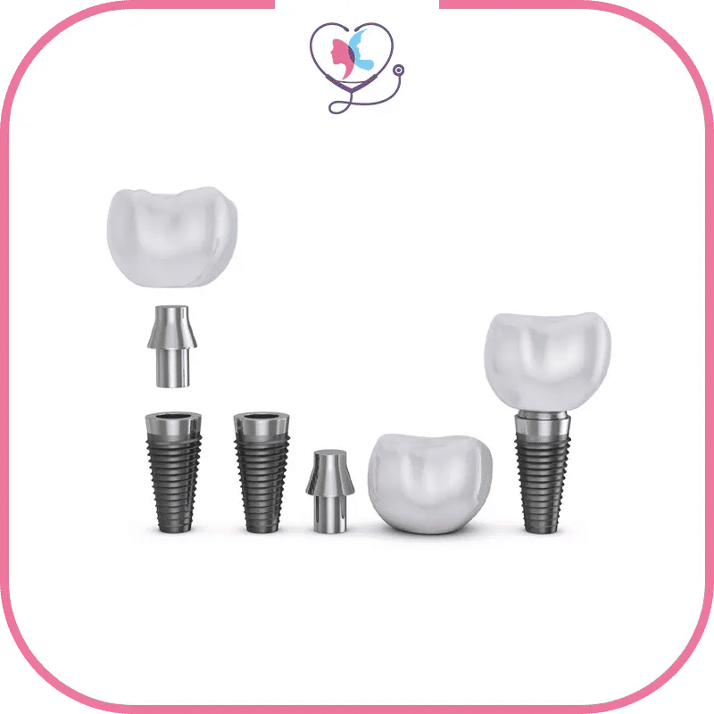 Am I Candidate for Dental Implants?
