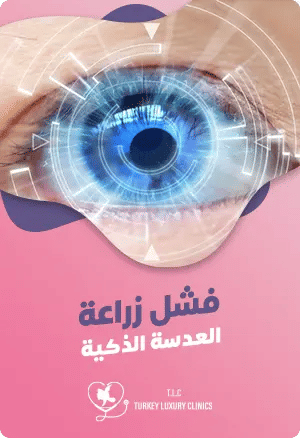 فشل زراعة العدسة الذكيةfeatured image