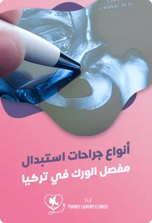 أنواع جراحة استبدال مفصل الورك في تركياfeatured image