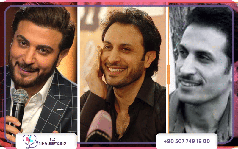 ماجد المهندس قبل وبعد التجميل